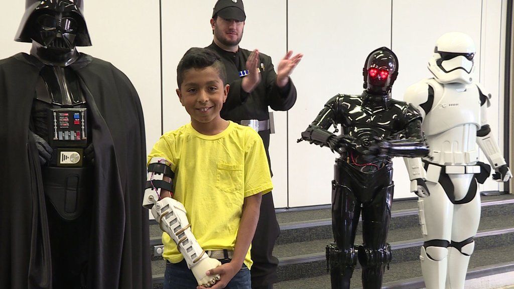 Dark Vador offre une prothèse imprimée en 3D à un jeune fan de Star Wars