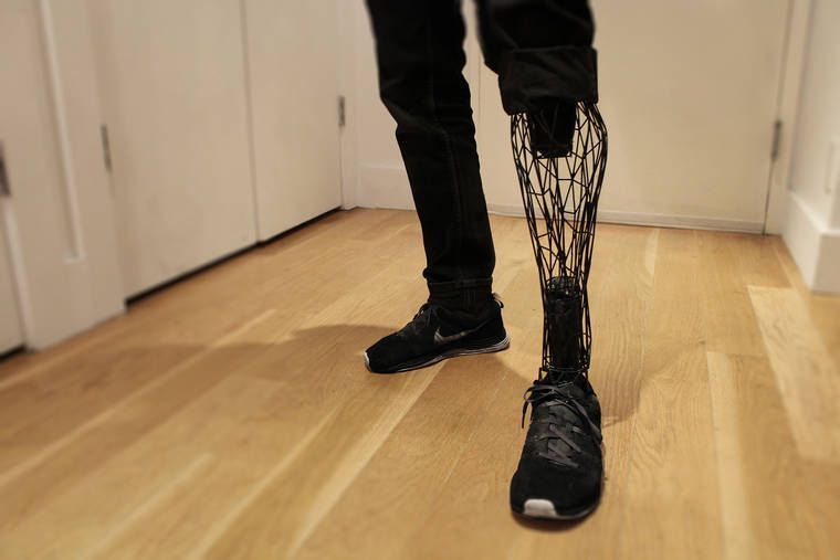 Exo Prosthetic Leg : la première prothèse en titane imprimée en 3D