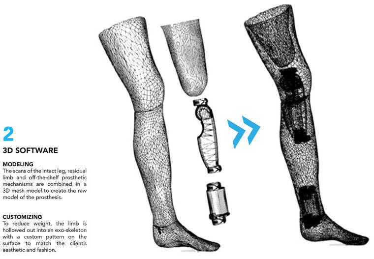 Exo Prosthetic Leg : la première prothèse en titane imprimée en 3D #5