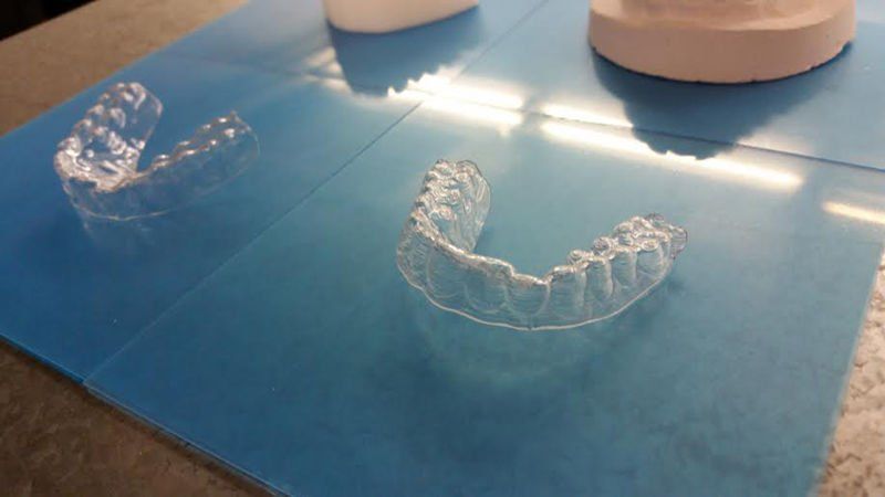 Impression 3D : un étudiant imagine un appareil dentaire à 60 dollars #3