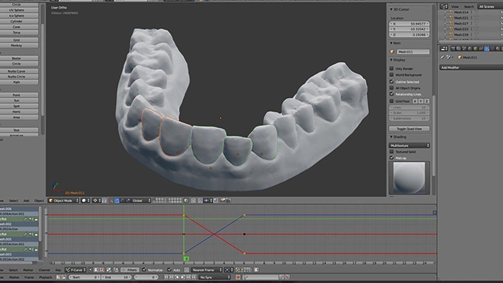 Impression 3D : un étudiant imagine un appareil dentaire à 60 dollars