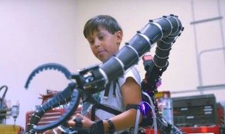 Un millionnaire de 19 ans s'offre une prothèse de bras inspirée du Docteur Octopus