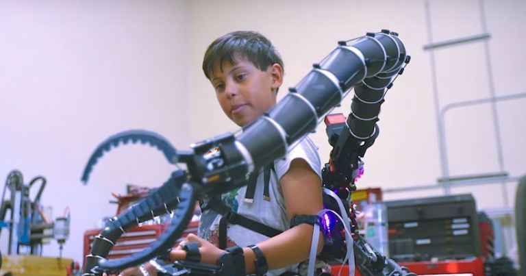 Un millionnaire de 19 ans s'offre une prothèse de bras inspirée du Docteur Octopus #2