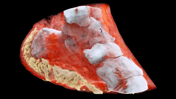 Des radiographies 3D couleurs d'un squelette humain impressionnantes #2