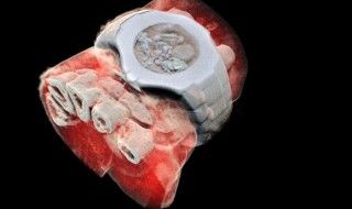Des radiographies 3D couleurs d'un squelette humain impressionnantes