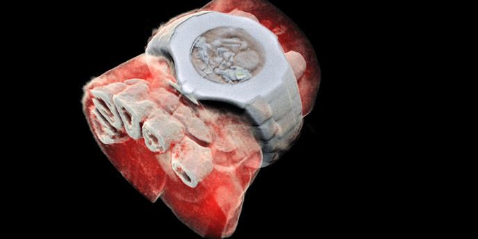 Des radiographies 3D couleurs d'un squelette humain impressionnantes
