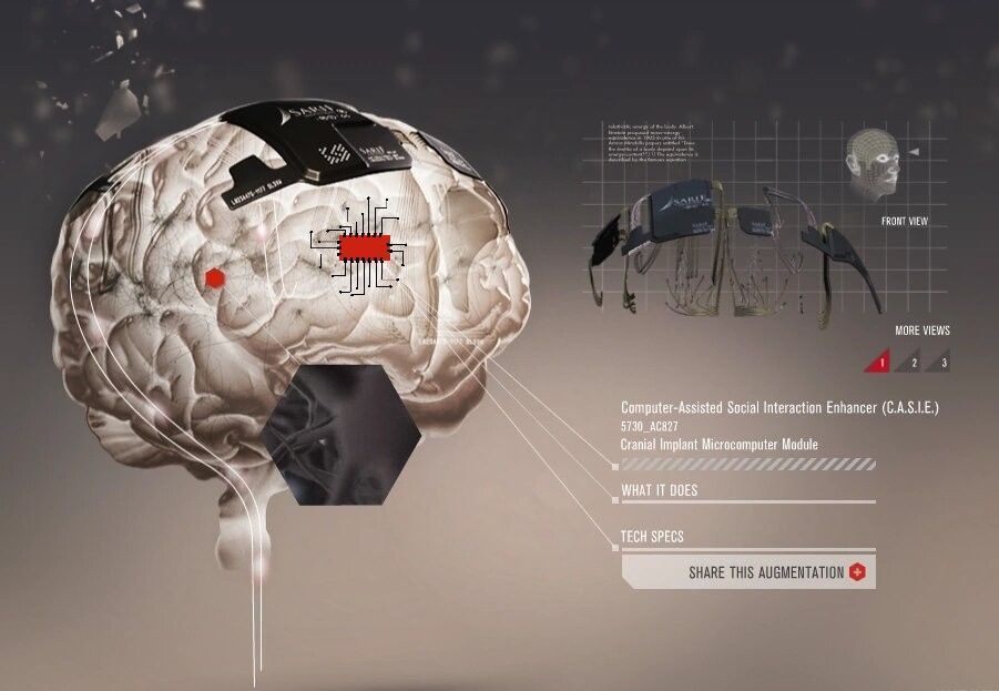 Neuralink : Elon Musk va présenter une puce qui rend plus intelligent et permet de connecter le cerveau aux machines