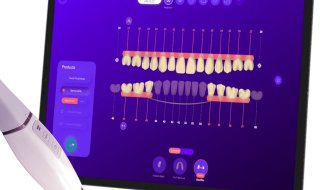 Le startup Fox 3D utilise l'IA pour concevoir et fabriquer des prothèses dentaires